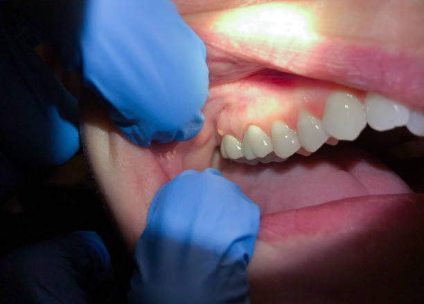 Best Broken or Cracked Tooth Emergency Dentist in Wilkinsburg, PA